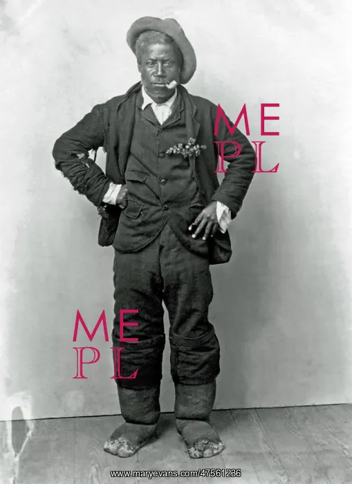  : Man with Elephantiasis, West Indies