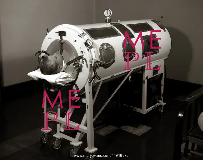 : Man lying in iron lung negative pressure ventilator : Man lying in iron lung negative pressure ventilator