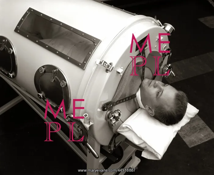 : Man lying in iron lung negative pressure ventilator : Man lying in iron lung negative pressure ventilator