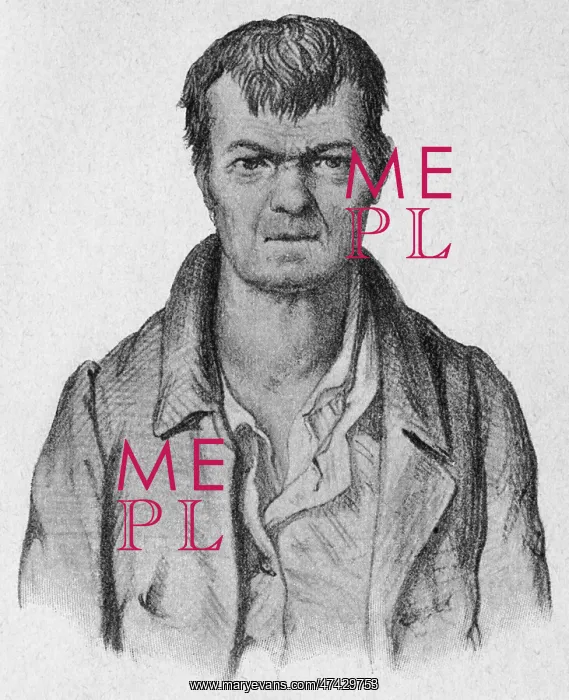 : Man with mental disability and goitre : Man with mental disability and goitre
