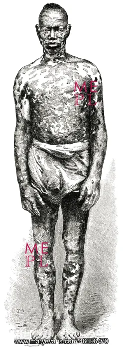  : Man - Mottled - Africa