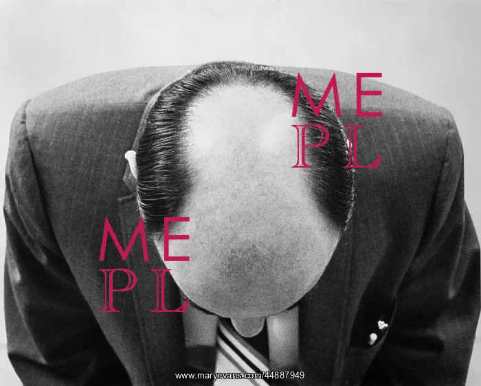  : Top Of Man'S Head From Above Can
