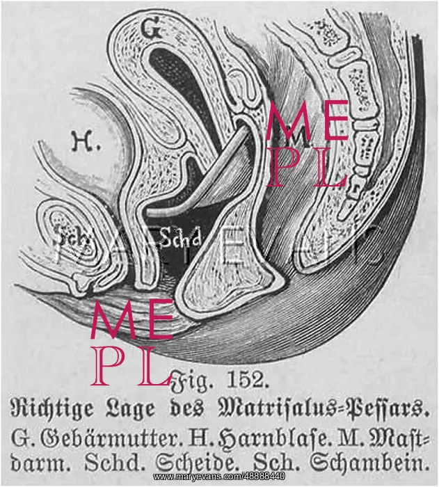 : MATRISALUS CAP / 1905 : MATRISALUS CAP / 1905