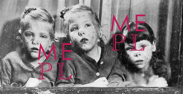 : Measles. These three Pittsburgh sisters were among the 600 : Measles. These three Pittsburgh sisters were among the 600