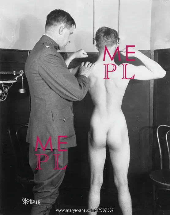 : Medical examination, WW1 : Medical examination, WW1