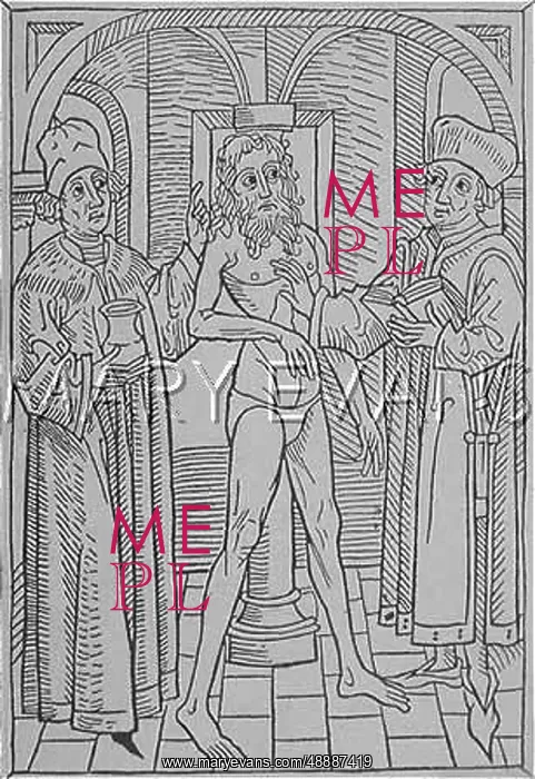 : MEDICAL / LEPER IN 1482 : MEDICAL / LEPER IN 1482