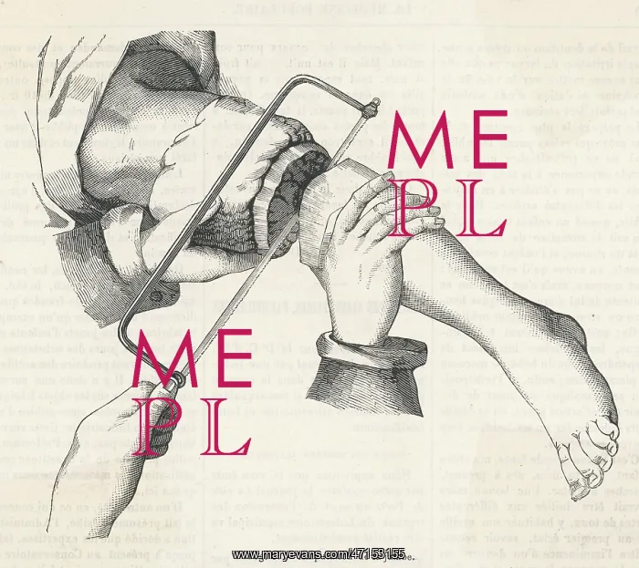  : MEDICAL / SURGERY / AMPUTATI