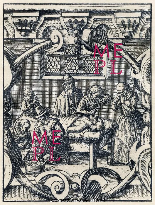  : MEDICAL / TREPANNING
