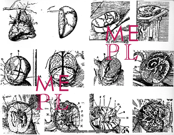 : medicine, anatomy, brain, Stephanus Riverinus : medicine, anatomy, brain, Stephanus Riverinus