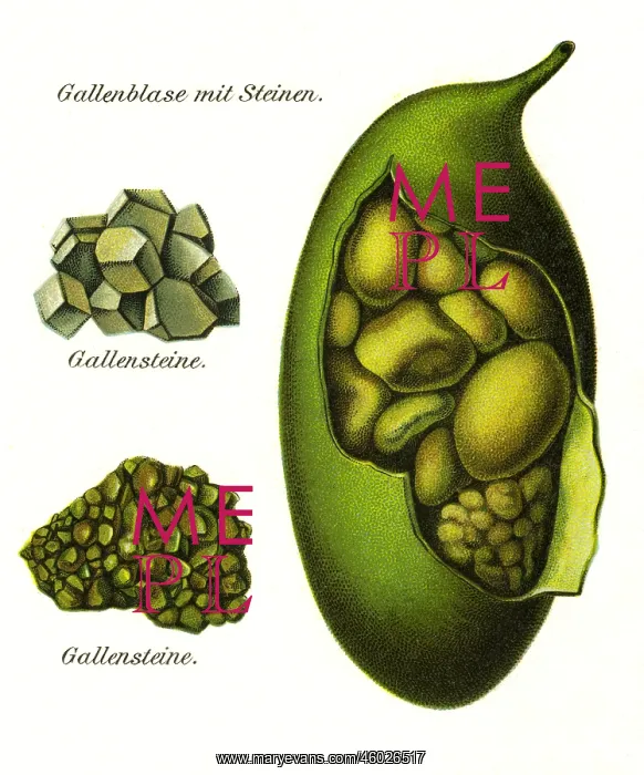  : medicine, anatomy, organs, gall bladder, lithograph