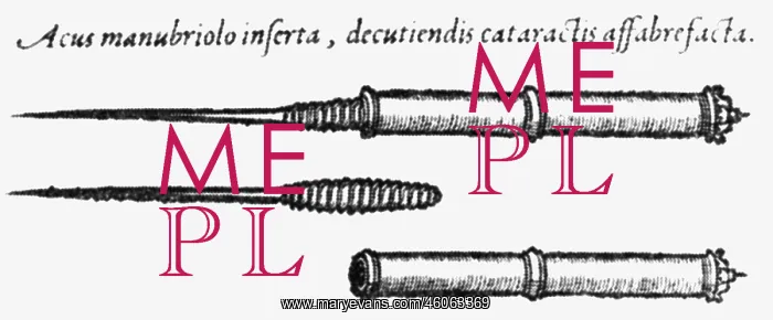 : medicine, ophthalmology, instruments, Glaucoma : medicine, ophthalmology, instruments, Glaucoma