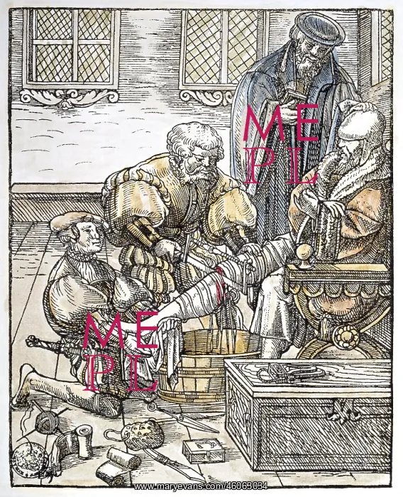 : medicine, surgery, amputation of the lower leg : medicine, surgery, amputation of the lower leg