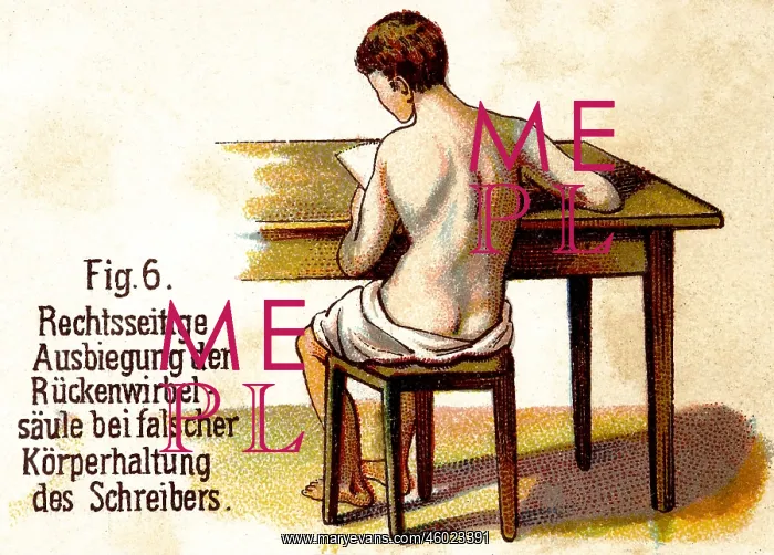 : medicine, warped spine as a result of wrong posture : medicine, warped spine as a result of wrong posture