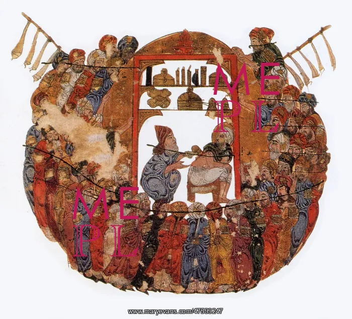 : Medieval Bloodletting : Medieval Bloodletting