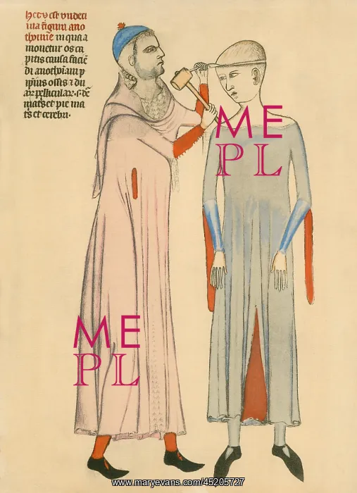 : Medieval doctor cutting open a patient's ? : Medieval doctor cutting open a patient's ?