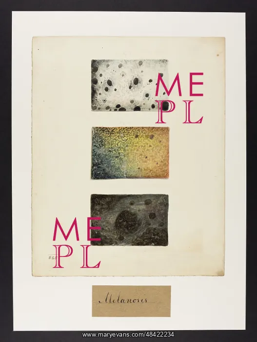 : Melanosis. (blank on verso - numbered 868) : Melanosis. (blank on verso - numbered 868)