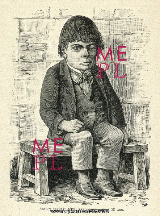 : Mentally deficient man - aged 35 : Mentally deficient man - aged 35
