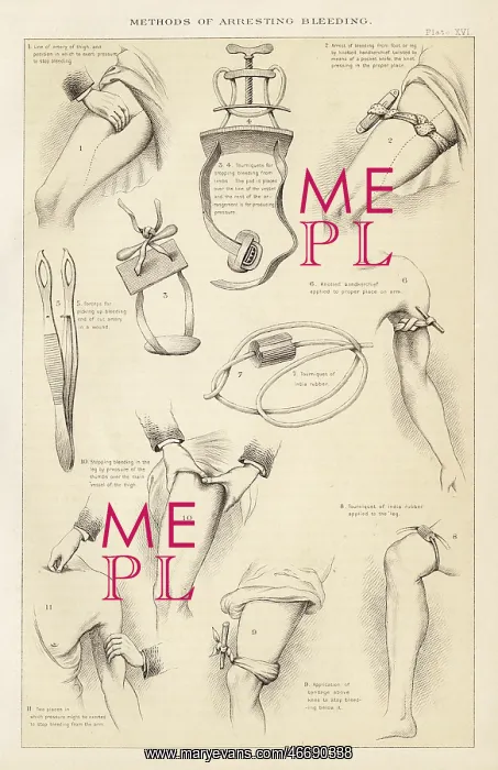 : Methods of Arresting Bleeding with various tourniquets : Methods of Arresting Bleeding with various tourniquets