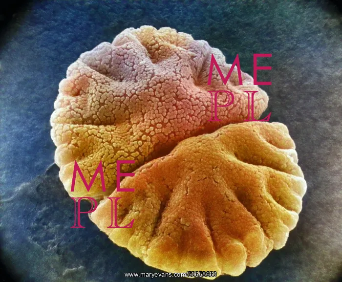 : Micrasterias angulosa, Algae, SEM : Micrasterias angulosa, Algae, SEM