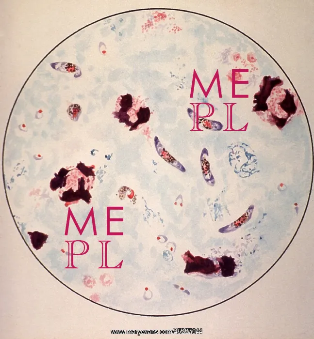 : Microscopic view of a malaria parasite painted ? : Microscopic view of a malaria parasite painted ?