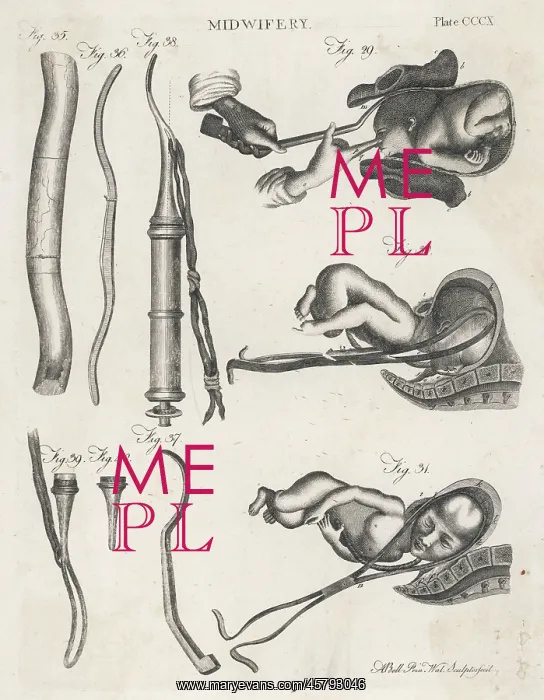 : MIDWIFERY IN 1768 : MIDWIFERY IN 1768