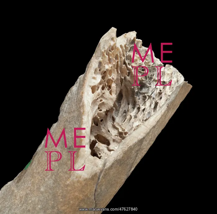: Moa bone fragment : Moa bone fragment