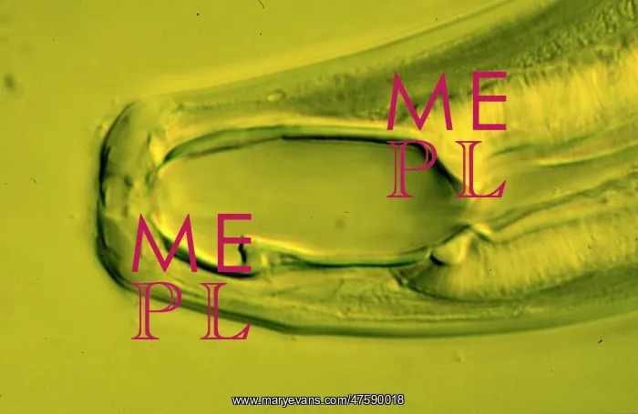 : Monochus aquaticus, nematode : Monochus aquaticus, nematode