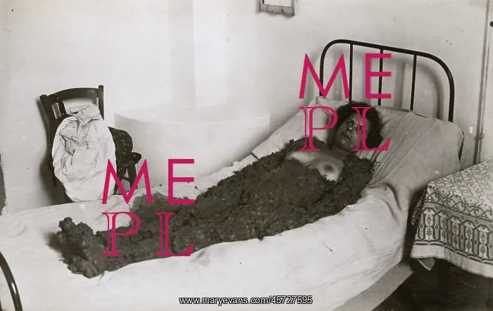  : Mud Therapy at a spa in Italy