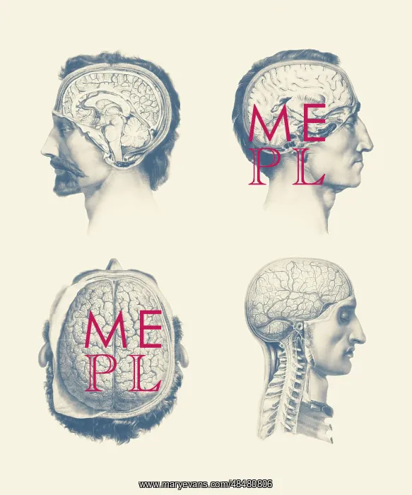 : Multiple views of a male's brain, showing the : Multiple views of a male's brain, showing the