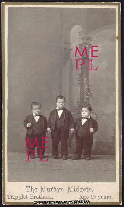 : The Murays Midgets, triplets, 19 years old, ? : The Murays Midgets, triplets, 19 years old, ?