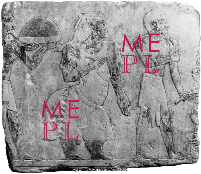 : Muscular Dystrophy, Ancient Egypt : Muscular Dystrophy, Ancient Egypt