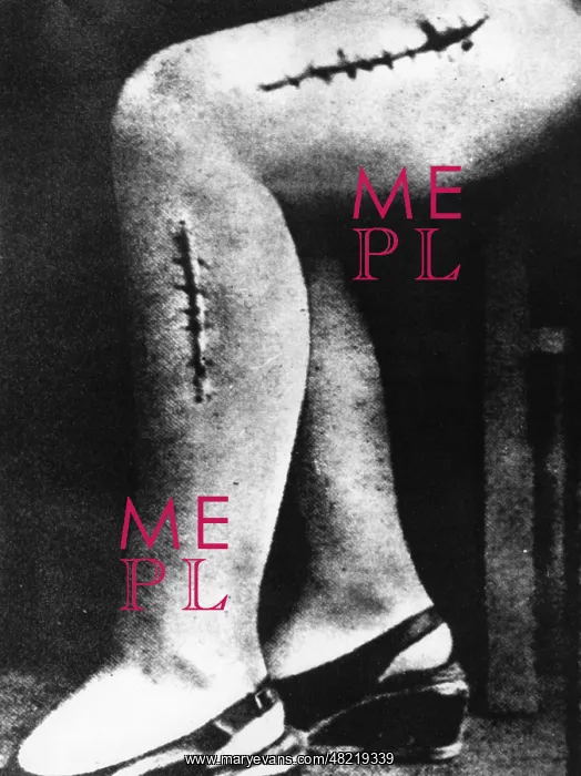 : Mutilation on a victim of an experiment in the Ravensbru : Mutilation on a victim of an experiment in the Ravensbru
