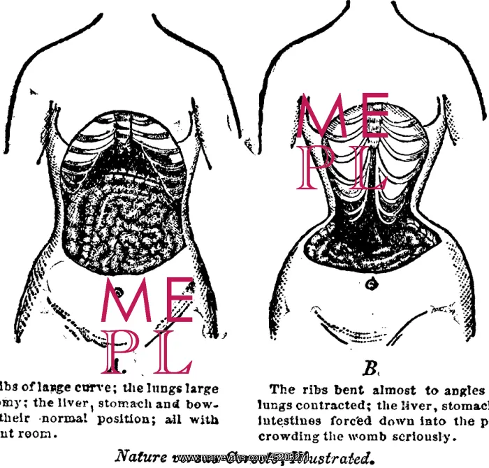 : Nature Versus Corsets. At left is the ? : Nature Versus Corsets. At left is the ?
