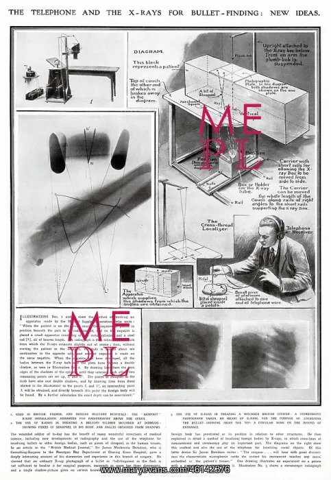 : New Ideas for using X-Rays for Medical use WWI : New Ideas for using X-Rays for Medical use WWI