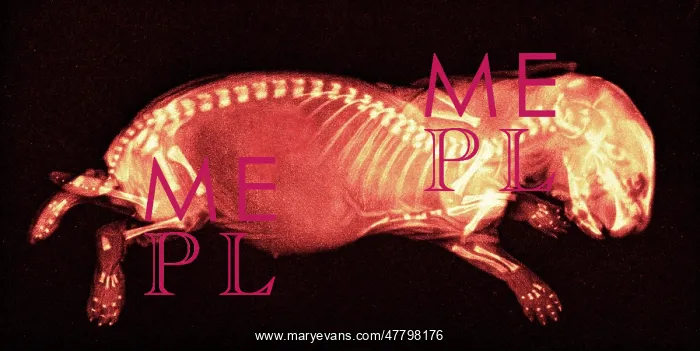 : Newborn Rabbit, X-ray, 1896 : Newborn Rabbit, X-ray, 1896