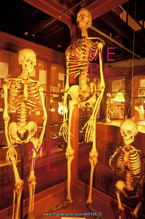 : Normal giant and dwarf human skeletons on display : Normal giant and dwarf human skeletons on display