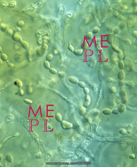 : Nostoc sp. A cyanobacterium. Members of this genus occur frequently in lichens : Nostoc sp. A cyanobacterium. Members of this genus occur frequently in lichens