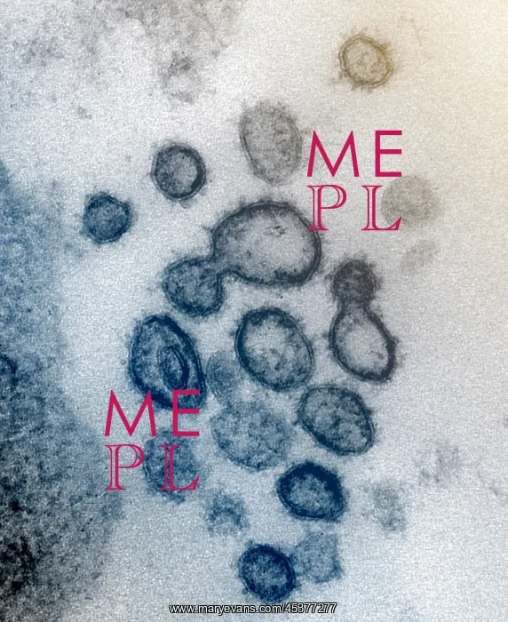 : Novel Coronavirus SARS-CoV-2, causes coronavirus : Novel Coronavirus SARS-CoV-2, causes coronavirus