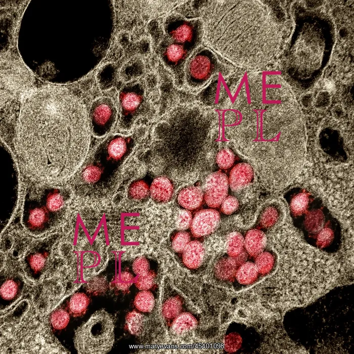 : Novel Coronavirus SARS-CoV-2, the virus that causes : Novel Coronavirus SARS-CoV-2, the virus that causes