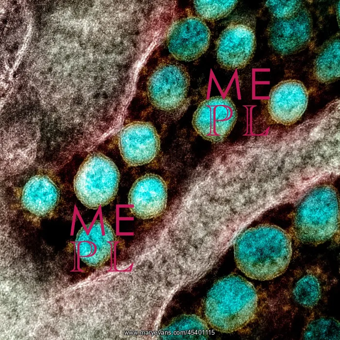 : Novel Coronavirus SARS-CoV-2, the virus that causes : Novel Coronavirus SARS-CoV-2, the virus that causes