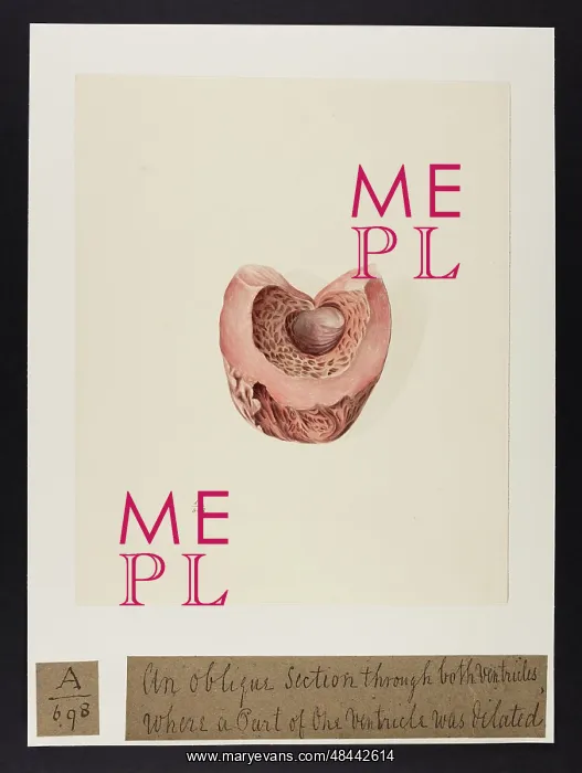 : An Oblique Section through both Ventricles : An Oblique Section through both Ventricles