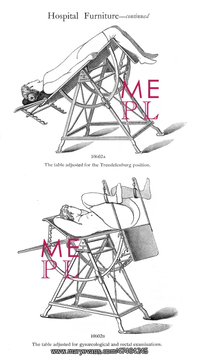 : OPERATION TABLE : OPERATION TABLE