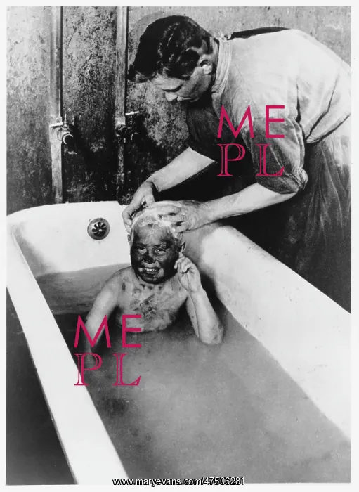 : ORPHAN IN BATH 1925 : ORPHAN IN BATH 1925
