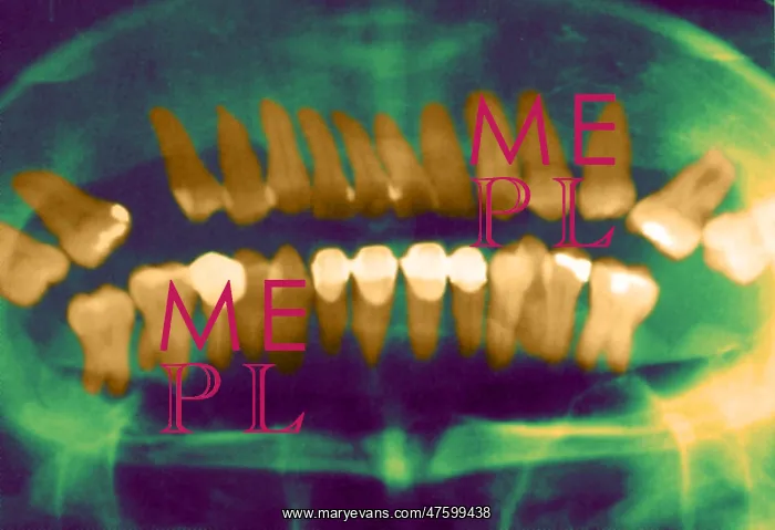 : Panoramic Dental X-Ray : Panoramic Dental X-Ray