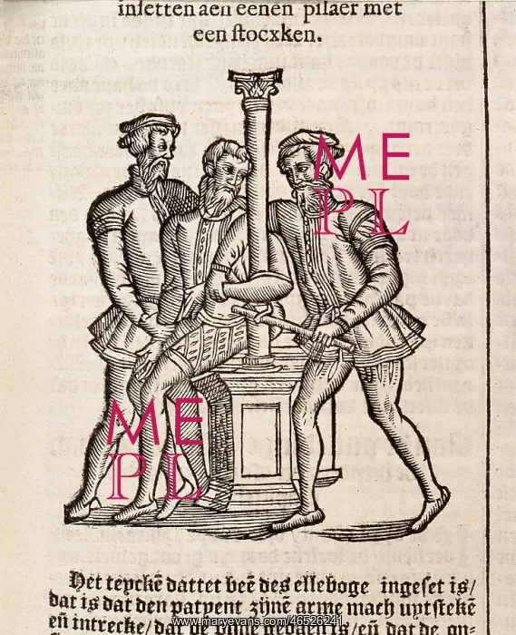 : PARE, Ambroise (1509-1590) : PARE, Ambroise (1509-1590)