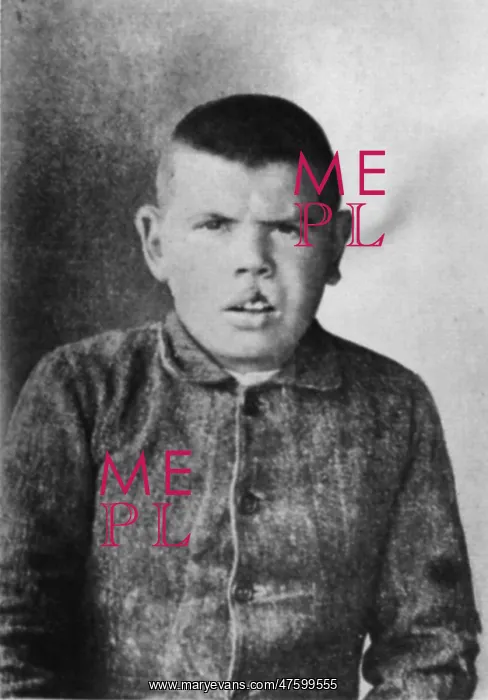 : Patient of Cesare Lombroso : Patient of Cesare Lombroso
