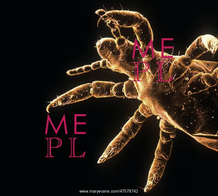 : Pediculus humanus, human head louse : Pediculus humanus, human head louse