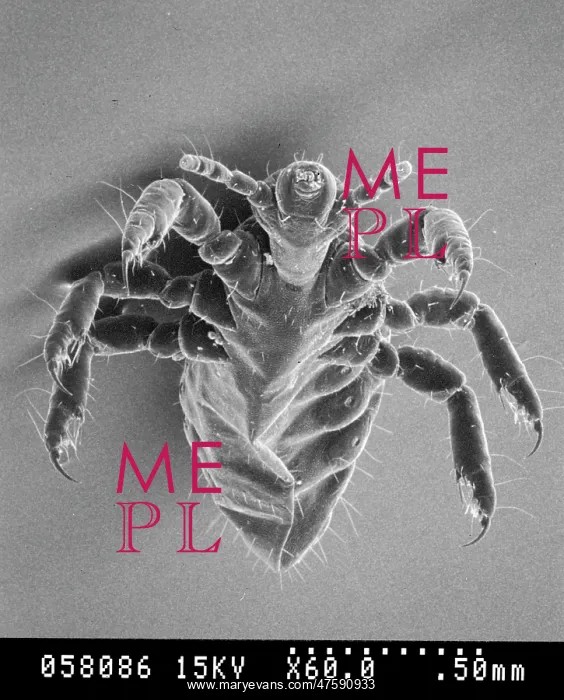 : Pediculus humanus, human head louse : Pediculus humanus, human head louse