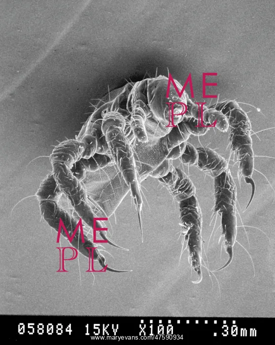 : Pediculus humanus, human head louse : Pediculus humanus, human head louse