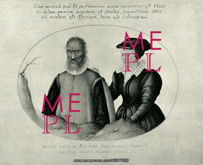 : Pedro Gonzalez, the hairy man : Pedro Gonzalez, the hairy man